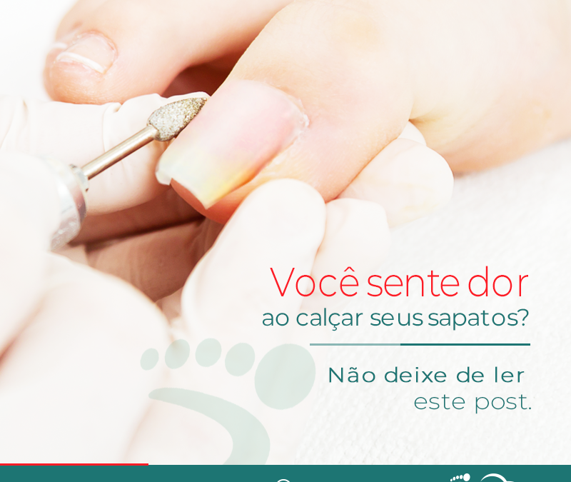 Unhas em Telha. Não sofra mais com esse problema.