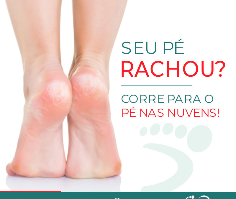 Rachaduras? Corre para o Pé nas Nuvens!