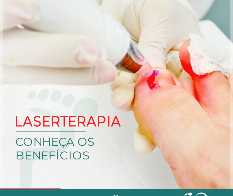 Laserterapia – Conheça os benefícios