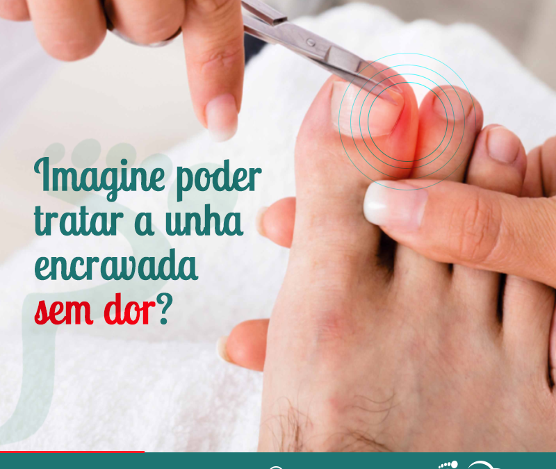 Unha encravada – Trate sem dor!