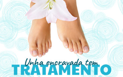 Unha encravada tem tratamento