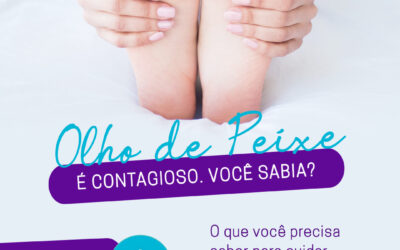 Olho de peixe é contagioso, você sabia?