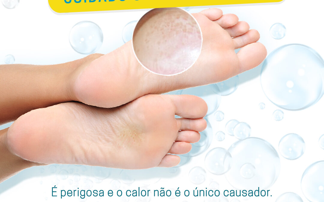 DESIDROSE – CUIDADO COM AS INFECÇÕES